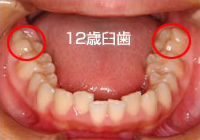 噛み合わせに問題がある症例